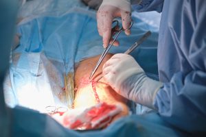 Joint Replacement Surgeon in Aundh